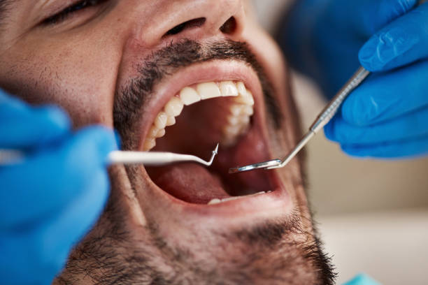 Best Emergency Dental Care for Broken or Chipped Teeth in East Greenville, PA