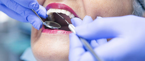 Best Emergency Treatment for Dental Infections or Abscesses in East Greenville, PA